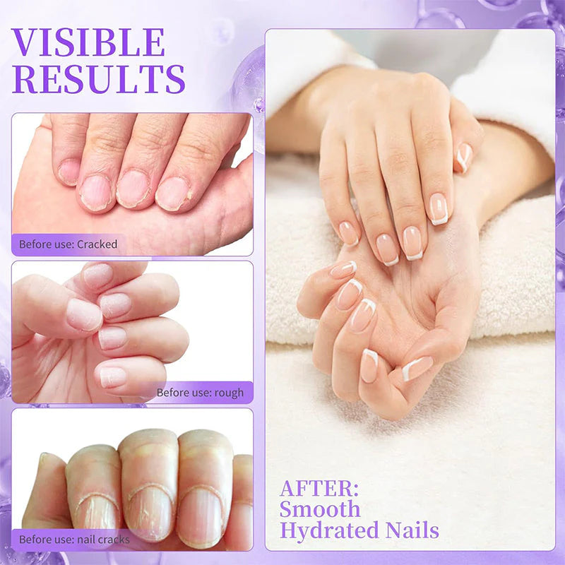 NailSoothe – Pflegender Nagelhautschieber-Ölstift